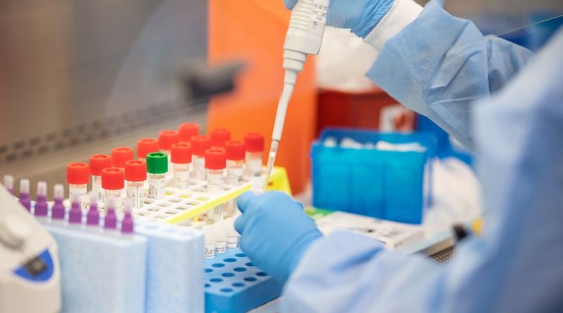 En este momento estás viendo Cuatro nuevos confirmados de coronavirus en Neuquén Capital 😷
