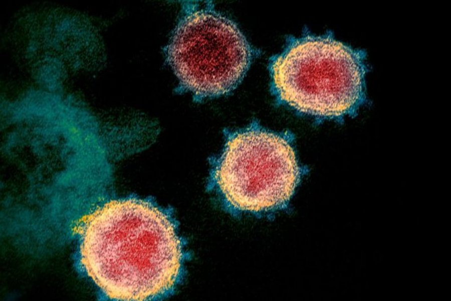 En este momento estás viendo Nuevo avance contra el coronavirus: Canadá logró aislar al patógeno 👩🏻‍🔬